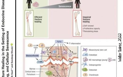 Fracturas en enfermedades endócrinas, envejecimiento y senescencia celular