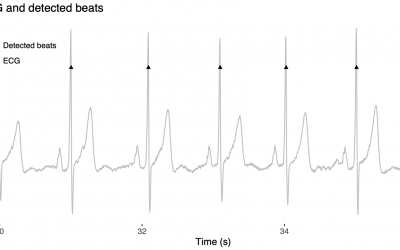 Variabilidad de la frecuencia cardíaca: fisiología y aplicaciones
